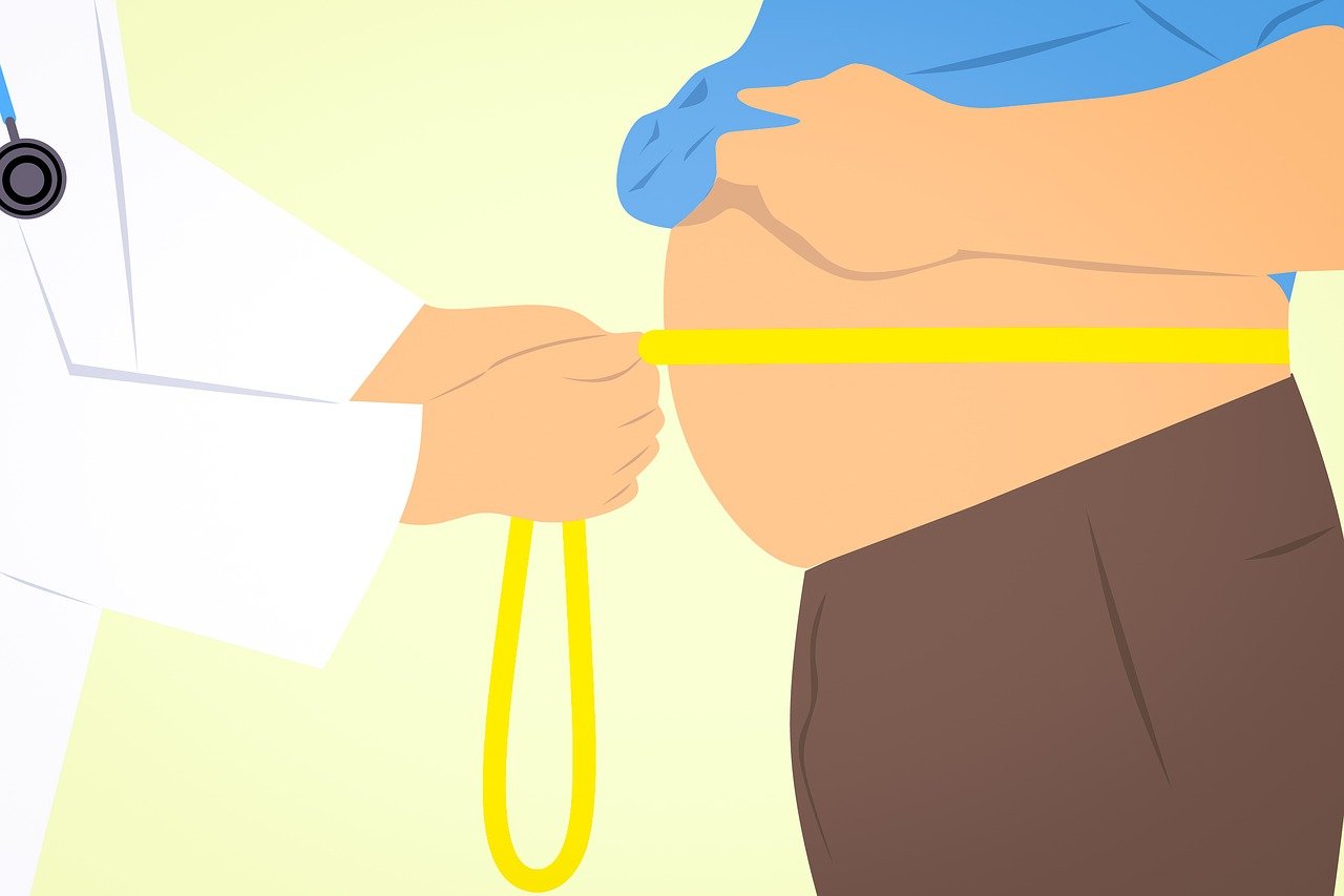 man obese weight loss nutritionist 3011213